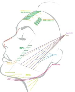 قیمت بهترین مارک نخ لیفت صورت 12 بعدی 1 قیمت بهترین مارک نخ لیفت