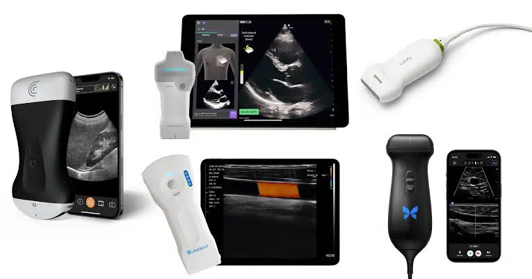 دستگاه سونوگرافی پرتابل قابل حمل | سامسونگ 1 sonography